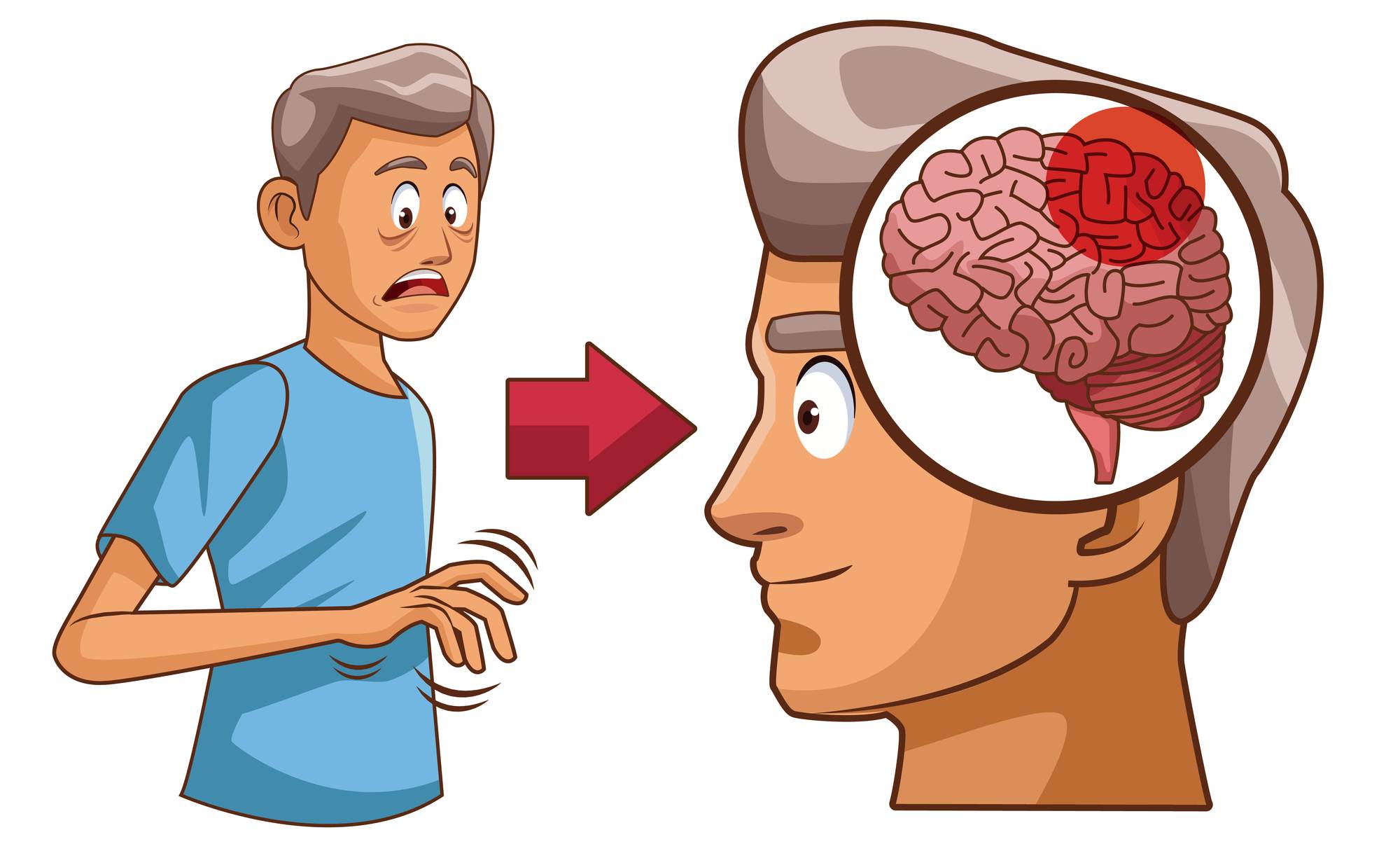 Brzké příznaky Parkinsonovy choroby Zdravestravovani.eu