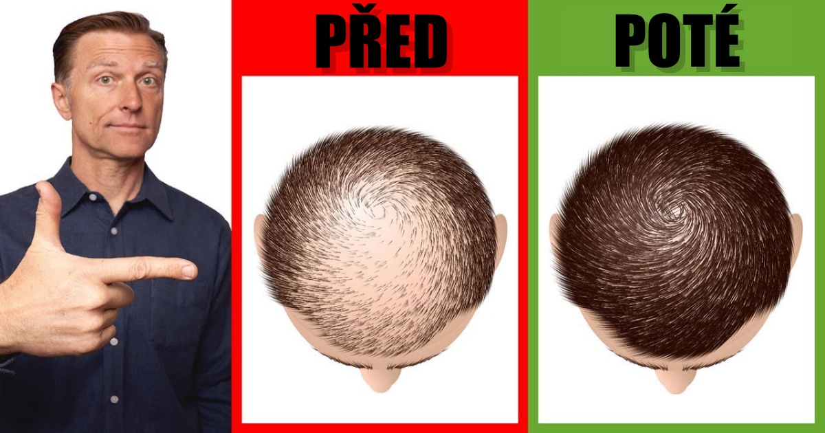 Domácí metody pro opětovný růst a konec vypadávání vlasů