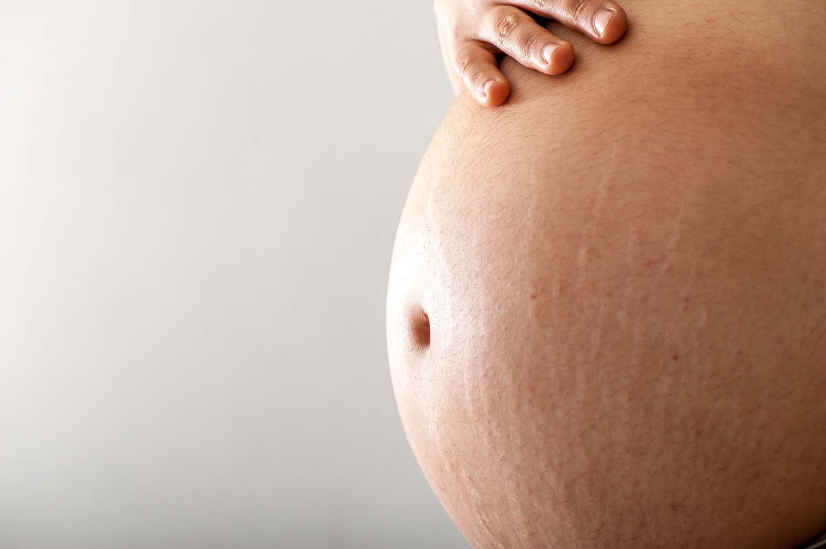 těhotenské břicho a strie